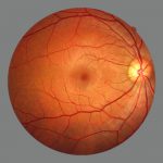 Esame fundus oculi e periferia retinica